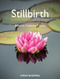Stillbirth
