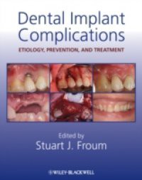 Dental Implant Complications